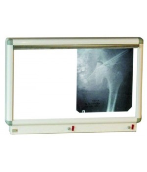 Негатоскоп НМ-1