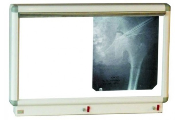 Негатоскоп НМ-2 euro двухкадровый