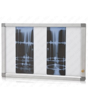 Негатоскоп общего назначения "Armed" 2-кадровый